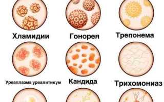 При каких женских болезнях помогает?