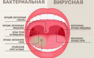 Причины заболевания: красное горло у грудничка