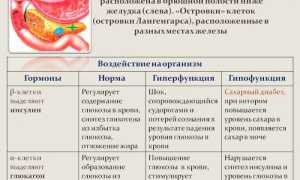 Симптомы и признаки заболеваний поджелудочной железы кратко