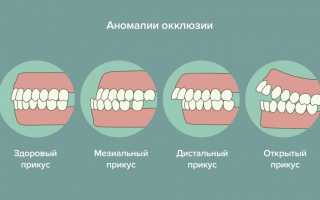Повод для беспокойства: бруксизм у грудничка