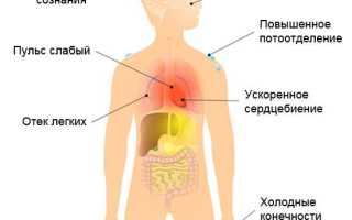 Кардиогенный шок неотложная помощь