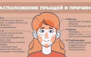 Почему появляются прыщи: прыщи на лице