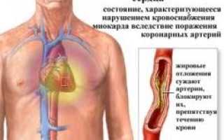 Экг неполная блокада пнпг